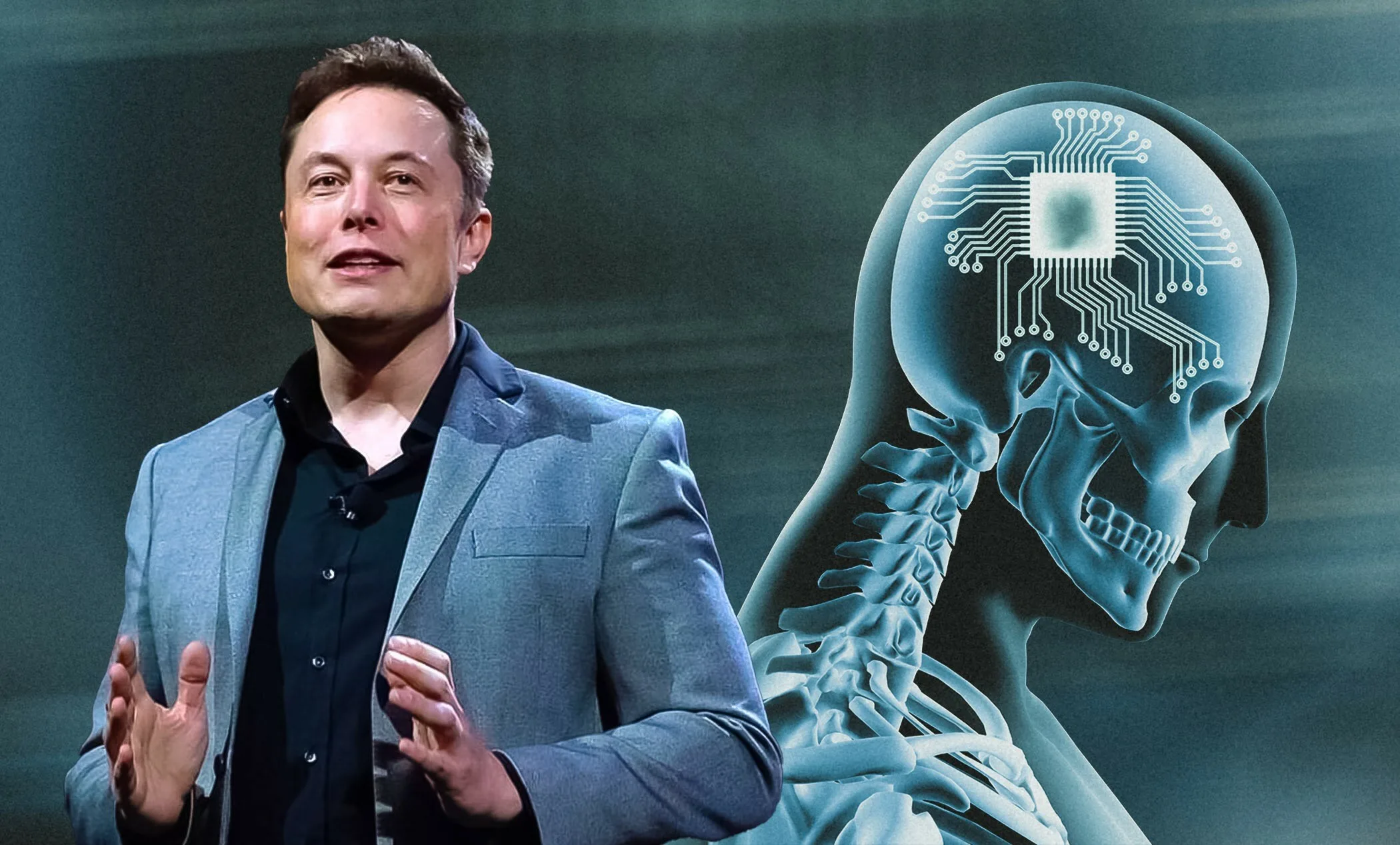 Neuralink обнародовала результаты эксперимента по вживлению первого мозгового импланта