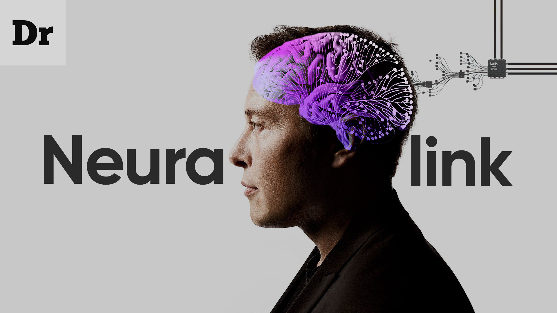 Neuralink рассчитывает к 2031 году вживлять по 20 тысяч чипов в год и выйти на $1 млрд выручки